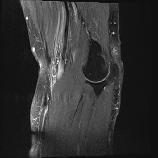 Click on the Serie image to view the images of Wieszt, Gnter